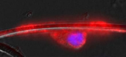 Стволовые клетки + нановолокна = перспективные исследования нервов